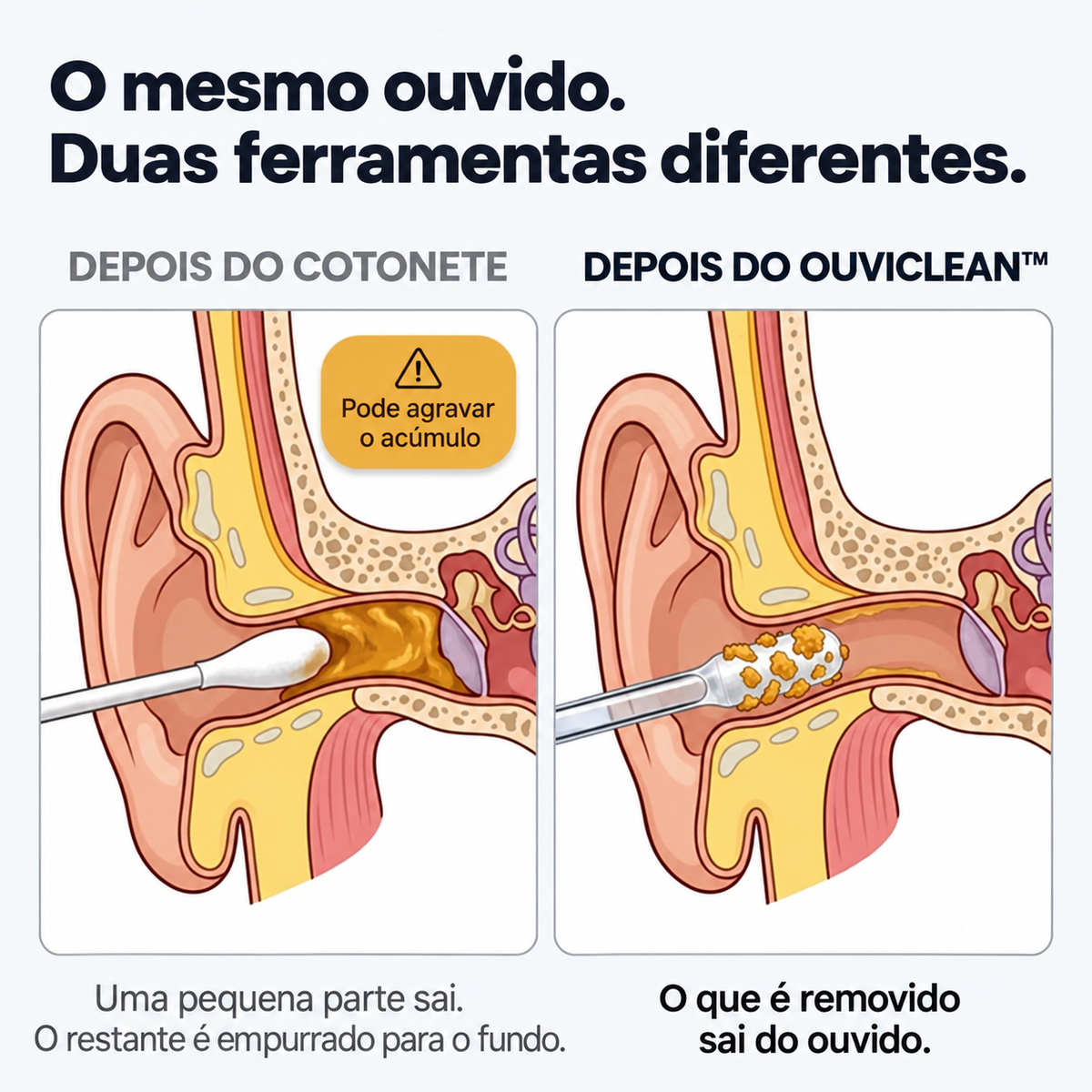 OuviClean™ – Limpador Auricular Adesivo Reutilizável